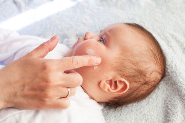 baby eczema cream
